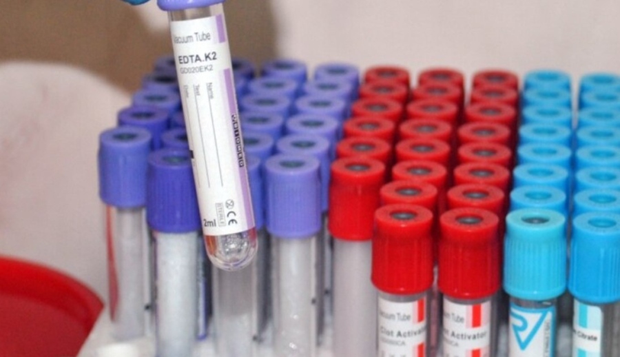 220 нови случая на COVID-19 у нас